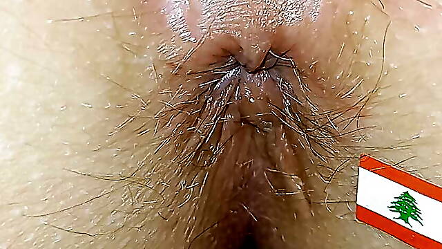 Beirut anus
