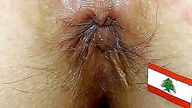 Beirut anus